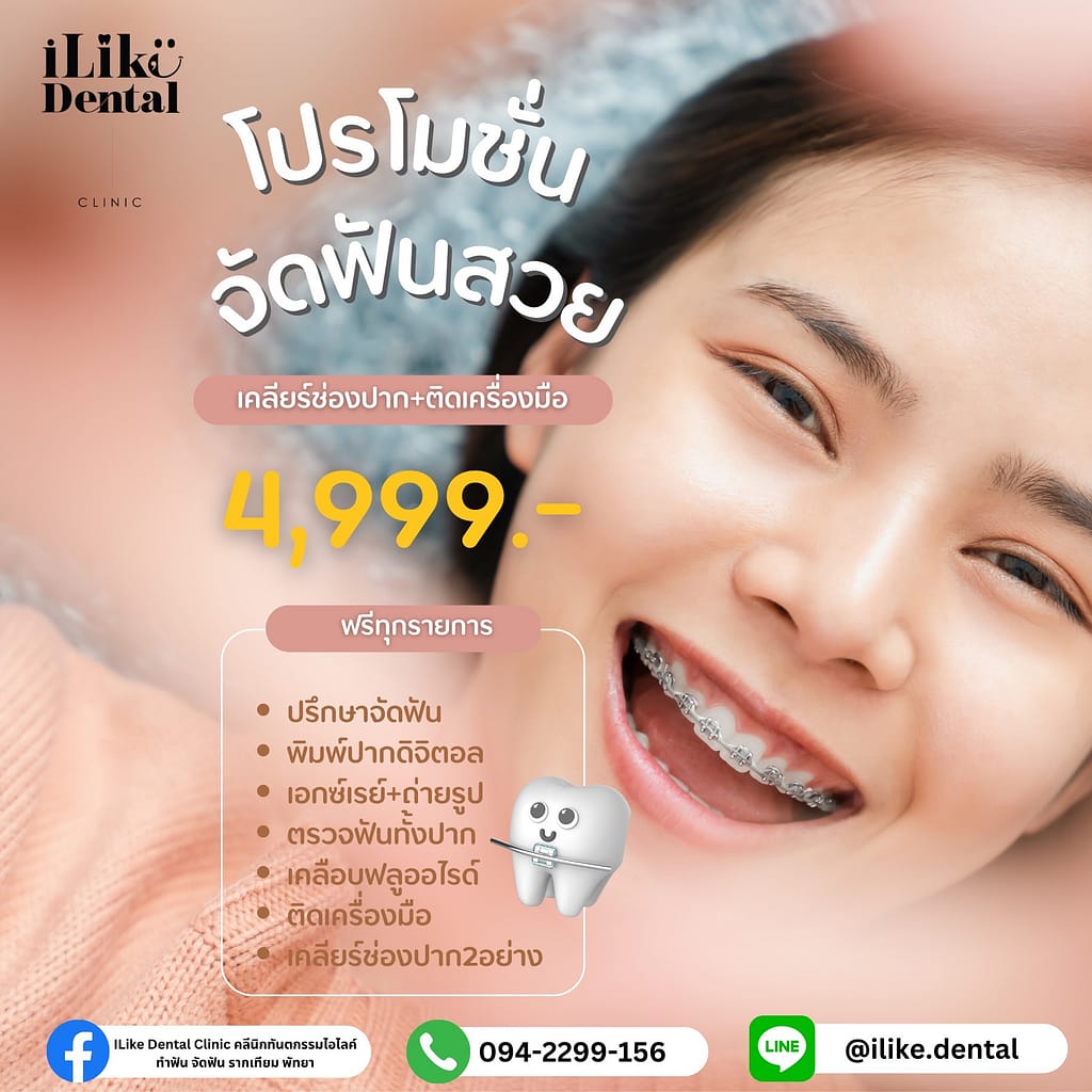 โปรจัดฟัน iLike Dental Clinic